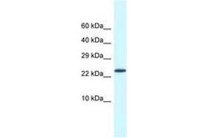Image no. 1 for anti-Cold Shock Domain Containing C2, RNA Binding (CSDC2) (AA 21-70) antibody (ABIN6747761) (CSDC2 anticorps  (AA 21-70))