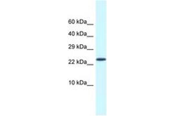 CSDC2 anticorps  (AA 21-70)