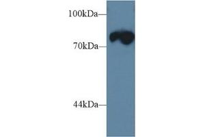 Detection of TRDN in Mouse Skeletal muscle lysate using Polyclonal Antibody to Triadin (TRDN) (Triadin anticorps  (AA 486-687))