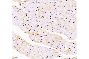 Immunohistochemistry of paraffin embedded rat heart using DDX19B (ABIN7073694) at dilution of 1: 1000 (400x lens)
