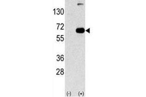 Western blot analysis of p6 antibody and 293 cell lysate (2 ug/lane) either nontransfected (Lane 1) or transiently transfected with the SQSTM1/p62 gene (2).