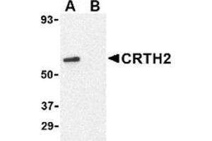 Western blot analysis of CRTH2 in Jurkat cell lysate with CRTH2 antibody at 1 μg/ml in (A) the absence and (B) presence of blocking peptide. (Prostaglandin D2 Receptor 2 (PTGDR2) (N-Term) anticorps)