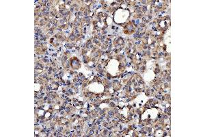 IHC analysis of SARS2 using anti-SARS2 antibody (ABIN7601804). (SARS2 anticorps  (AA 46-518))