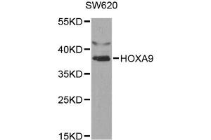 Western blot analysis of extracts of SW620 cells, using HOXA9 antibody (ABIN5970979) at 1/1000 dilution. (HOXA9 anticorps)