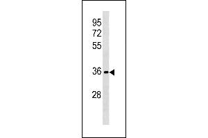 RFPL3 Antibody (N-term) (ABIN1881745 and ABIN2843224) western blot analysis in HL-60 cell line lysates (35 μg/lane). (RFPL3 anticorps  (N-Term))