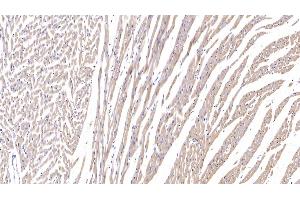 Detection of RSPO1 in Rat Cardiac Muscle Tissue using Polyclonal Antibody to R-Spondin 1 (RSPO1)