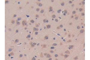 Detection of IL11Ra in Mouse Cerebrum Tissue using Polyclonal Antibody to Interleukin 11 Receptor Alpha (IL11Ra) (IL11RA anticorps  (AA 194-329))