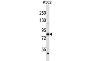 ABTB2 Antibody (C-term) western blot analysis in K562 cell line lysates (35 µg/lane).