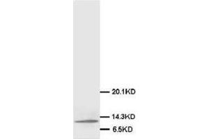 Western blot analysis of Mammary cancer tissue lysis using MIF antibody (MIF anticorps  (C-Term))