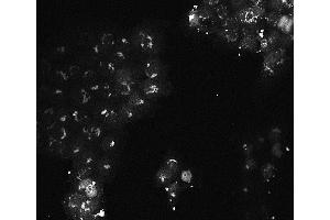 Immunofluorescence of Mouse monoclonal anti-AKT3 antibody Cell Type: A431 cells Fixation: 4% paraformaldehyde 10 min Permeablization: 0. (AKT3 anticorps  (Internal Region))