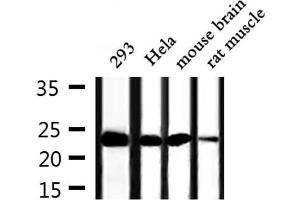 Western blot analysis of extracts from 293,Hela,mouse brain and rat muscle, using TPT1 Antibody. (TPT1 anticorps  (Internal Region))