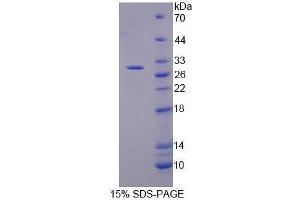 SDS-PAGE analysis of Human Mucin 17 Protein. (MUC17 Protéine)