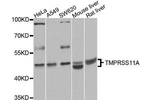 Western blot analysis of extracts of various cell lines, using TMPRSS11A antibody.