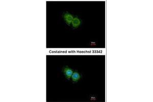ICC/IF Image Immunofluorescence analysis of methanol-fixed Hep G2, using CXCR1, antibody at 1:500 dilution. (CXCR1 anticorps  (C-Term))