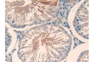 Detection of TBG in Rat Testis Tissue using Polyclonal Antibody to Thyroxine Binding Globulin (TBG)