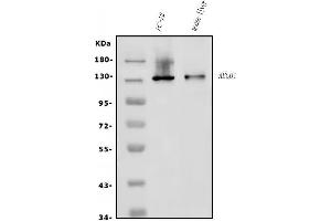 Western blot analysis of P Glycoprotein/ABCB1 using anti-P Glycoprotein/ABCB1 antibody (ABIN7602262).