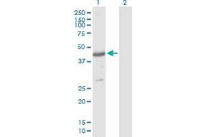 Western Blot analysis of CYTH4 expression in transfected 293T cell line by CYTH4 MaxPab polyclonal antibody. (Cytohesin 4 anticorps  (AA 1-394))