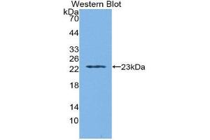 Western Blotting (WB) image for anti-Tryptophanyl-tRNA Synthetase (WARS) (AA 29-195) antibody (ABIN1860958) (WARS anticorps  (AA 29-195))