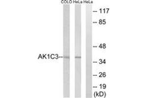 Western blot analysis of extracts from HeLa/COLO cells, using AKR1C3 Antibody. (AKR1C3 anticorps  (AA 191-240))