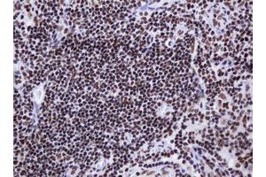 Image no. 8 for anti-Decapping Enzyme, Scavenger (DCPS) antibody (ABIN1497781)