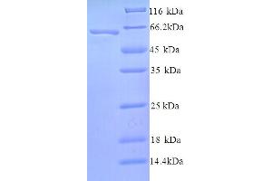 SDS-PAGE (SDS) image for SWI/SNF Related, Matrix Associated, Actin Dependent Regulator of Chromatin, Subfamily A, Member 2 (SMARCA2) (AA 700-1216), (partial) protein (His tag) (ABIN5713844)