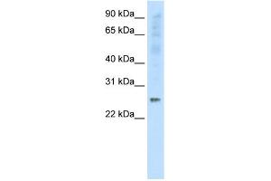 WB Suggested Anti-SNAP25 Antibody Titration:  0.