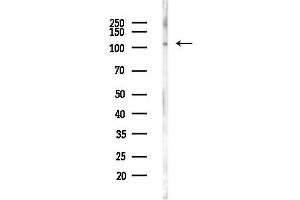 anti-Smith-Magenis Syndrome Chromosome Region, Candidate 8 (SMCR8) antibody