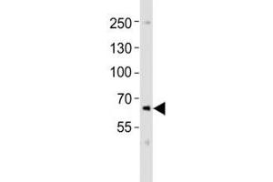 Western blot analysis of lysate from SK-N-MC cell line using PCSK9 antibody at 1:1000.
