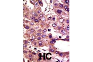 Immunohistochemistry (IHC) image for anti-Autocrine Motility Factor Receptor (AMFR) antibody (ABIN2995186) (AMFR anticorps)