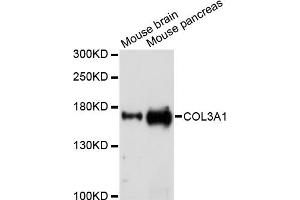 Western blot analysis of extracts of various cell lines, using COL3A1 antibody (ABIN5971985) at 1/1000 dilution. (COL3A1 anticorps)