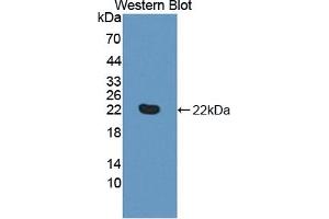 Detection of Recombinant TNFRSF14, Human using Polyclonal Antibody to Tumor Necrosis Factor Receptor Superfamily, Member 14 (TNFRSF14) (HVEM anticorps  (AA 41-209))