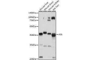 Western blot analysis of extracts of various cell lines, using ASL antibody (ABIN6127448, ABIN6137201, ABIN6137202 and ABIN6221972) at 1:1000 dilution.