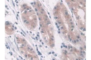 IHC-P analysis of Human Stomach Tissue, with DAB staining. (LDHD anticorps  (AA 62-265))