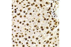 Immunohistochemistry of paraffin-embedded Rat liver using H3K27me2 antibody at dilution of 1:100 (x400 lens).