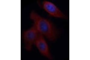 ABIN6268649 staining murine bone marrow-derived macrophages by ICC/IF.