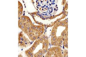 Immunohistochemical analysis of paraffin-embedded M.