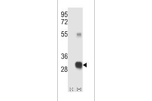 Western blot analysis of RCE1 (arrow) using rabbit polyclonal RCE1 Antibody (W57) (ABIN389050 and ABIN2839259). (RCE1/FACE2 anticorps  (N-Term))