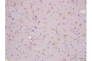 Formalin-fixed and paraffin embedded rat brain labeled with Anti-SLCO2B1/OATPB Polyclonal Antibody, Unconjugated (ABIN751048) at 1:200 followed by conjugation to the secondary antibody and DAB staining