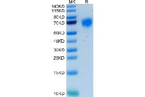 Human FGFR4 on Tris-Bis PAGE under reduced condition.