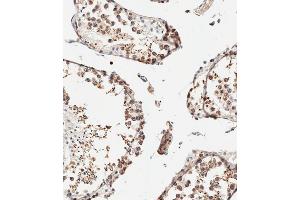 Immunohistochemical analysis of paraffin-embedded human testis tissue using C performed on the Leica® BOND RXm. (IFITM5 anticorps  (AA 55-83))