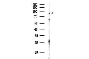 anti-Disabled Homolog 2, Mitogen-Responsive phosphoprotein (Drosophila) (DAB2) (C-Term) antibody