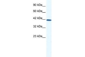 WB Suggested Anti-SOX11 Antibody Titration: 0. (SOX11 anticorps  (N-Term))
