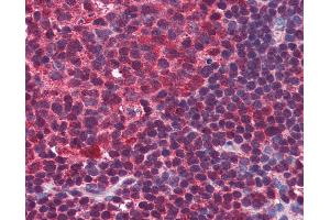 Anti-BLIMP-1 antibody IHC of human colon, lymphoid follicle. (PRDM1 anticorps  (C-Term))