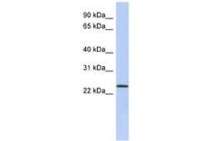 Image no. 1 for anti-UL16 Binding Protein 1 (ULBP1) (N-Term) antibody (ABIN6743537) (ULBP1 anticorps  (N-Term))