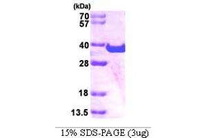 SDS-PAGE (SDS) image for Spastic Paraplegia 21 (SPG21) (AA 1-308) protein (His tag) (ABIN666752)