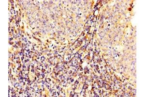 IHC image of ABIN7146540 diluted at 1:300 and staining in paraffin-embedded human tonsil tissue performed on a Leica BondTM system. (Calpain 2 anticorps  (Catalytic Subunit))