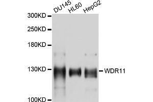 Western blot analysis of extracts of various cell lines, using WDR11 antibody (ABIN4905619) at 1:1000 dilution. (WDR11 anticorps)