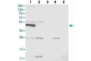 Western blot analysis of Lane 1: RT-4, Lane 2: U-251 MG, Lane 3: Human Plasma, Lane 4: Liver, Lane 5: Tonsil with SLC10A3 polyclonal antibody . (SLC10A3 anticorps)