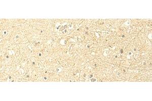 Immunohistochemistry of paraffin-embedded Human brain tissue using MTHFS Polyclonal Antibody at dilution of 1:50(x200) (MTHFS anticorps)