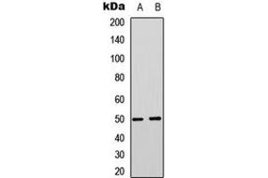 Western blot analysis of MCT4 expression in Jurkat (A), PC3 (B) whole cell lysates. (SLC16A3 anticorps  (Center))